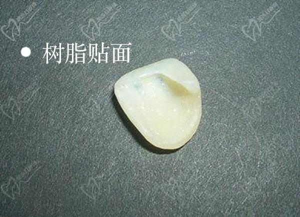 樹(shù)脂貼面（冰瓷貼面）