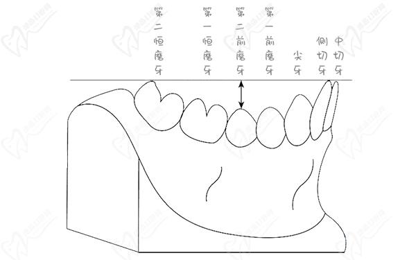 正畸spee曲線的測量圖