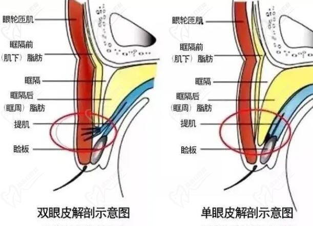 杜圓圓修復雙眼皮水平怎么樣