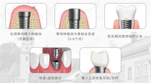 武漢中諾口腔醫(yī)院怎么樣