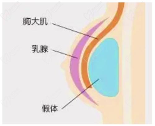 四川米蘭柏羽醫(yī)療美容隆胸技術(shù)高超