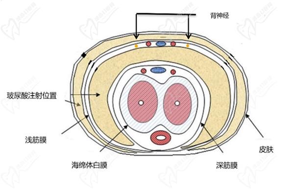 男性生殖整形手術(shù)費用大概需要多少錢