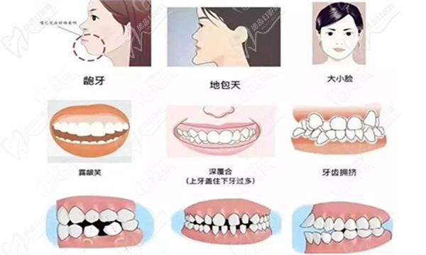 37歲做牙齒矯正需要幾年