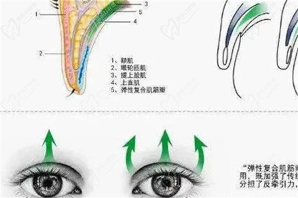 佀同帥擅長哪種雙眼皮