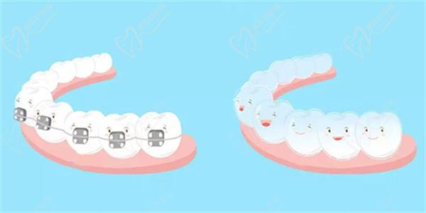 鄭州兒童牙齒矯正價(jià)格多少錢