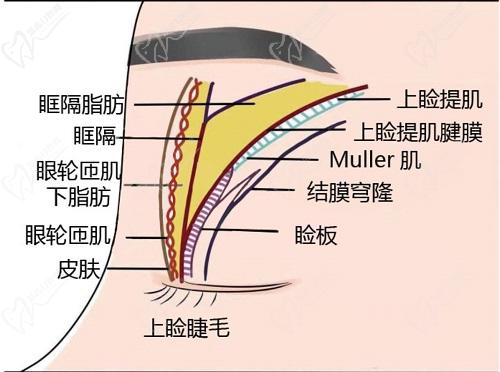 師麗麗雙眼皮修復技術