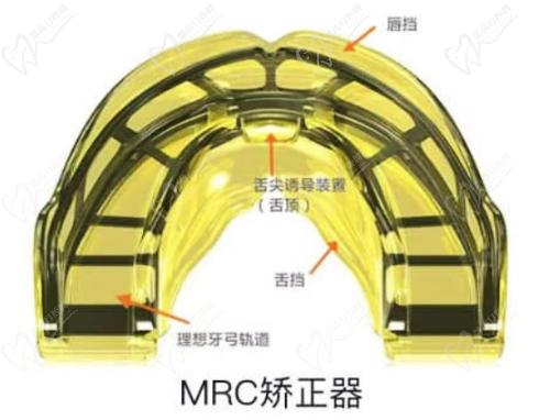 兒童牙齒早期矯正eta和mrc