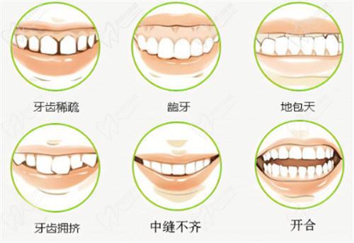 2025年國內(nèi)牙齒矯正價格因矯正方式、醫(yī)院級別和地區(qū)差異而有所不同