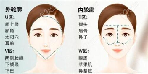 三、小拉皮+面部吸脂提升手術(shù)實(shí)例解讀