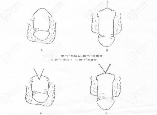 李世榮延長(zhǎng)手術(shù)的高定價(jià)，本質(zhì)上是醫(yī)療價(jià)值的真實(shí)體現(xiàn)