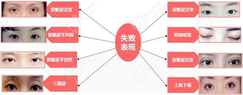 七、術(shù)前準(zhǔn)備與注意事項