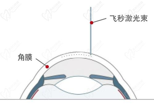 王曉瑛醫(yī)生在哪里出診？上海普瑞、上海和平等眼科醫(yī)院可預約