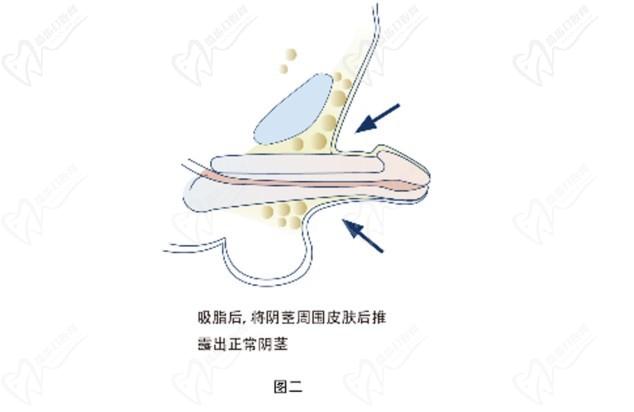 重慶李世榮教授坐診時間及在線預約開啟！想“變強”做男科手術(shù)找李世榮男性健康管理中心準沒錯