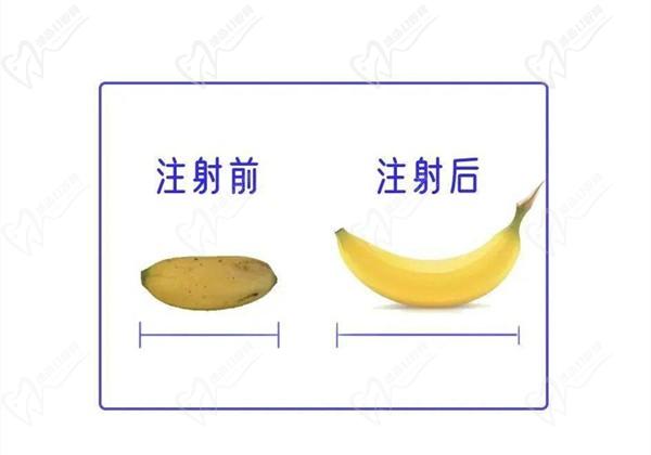 李世榮做一次延長手術(shù)多少錢？2025年李世榮男科價格表延長手術(shù)4.5w+假體植入3w+注射增粗5萬起